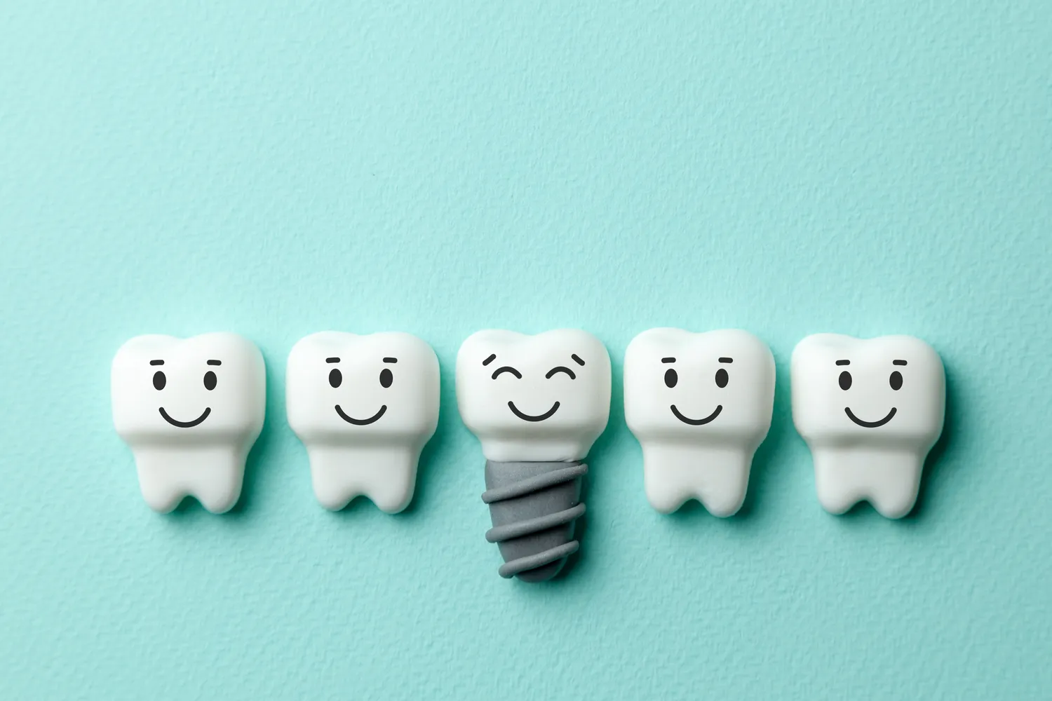 Ile trwa kanałowe leczenie?