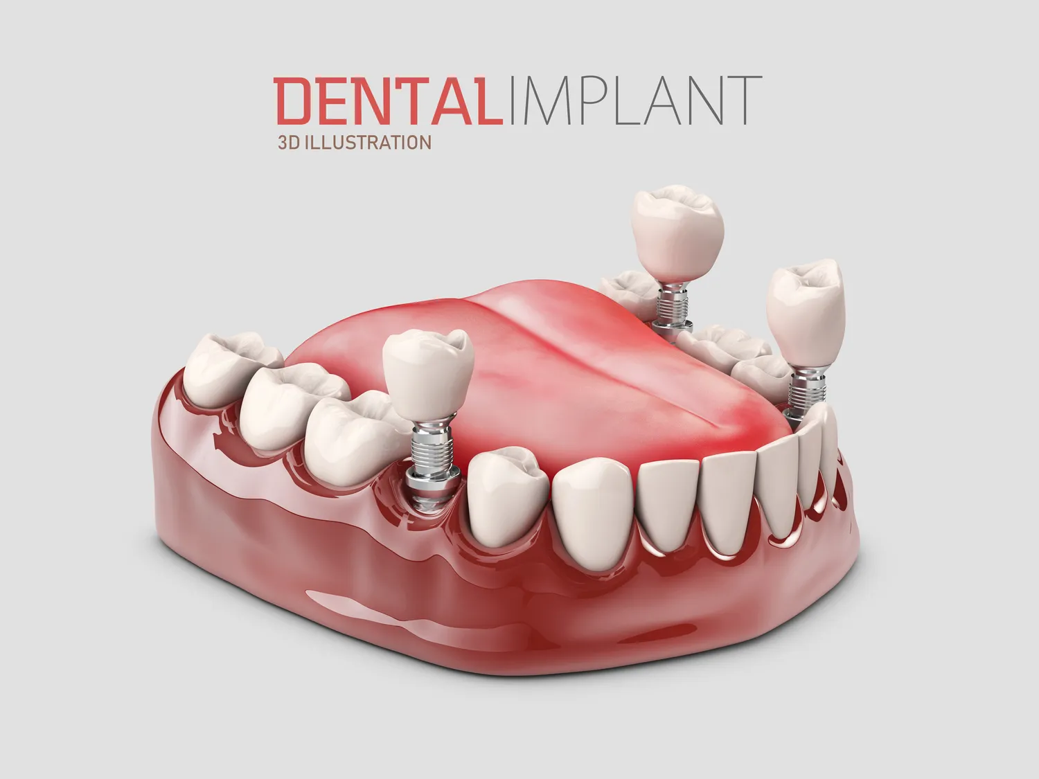 czym-sie-rozni-stomatolog-od-dentysty-1
