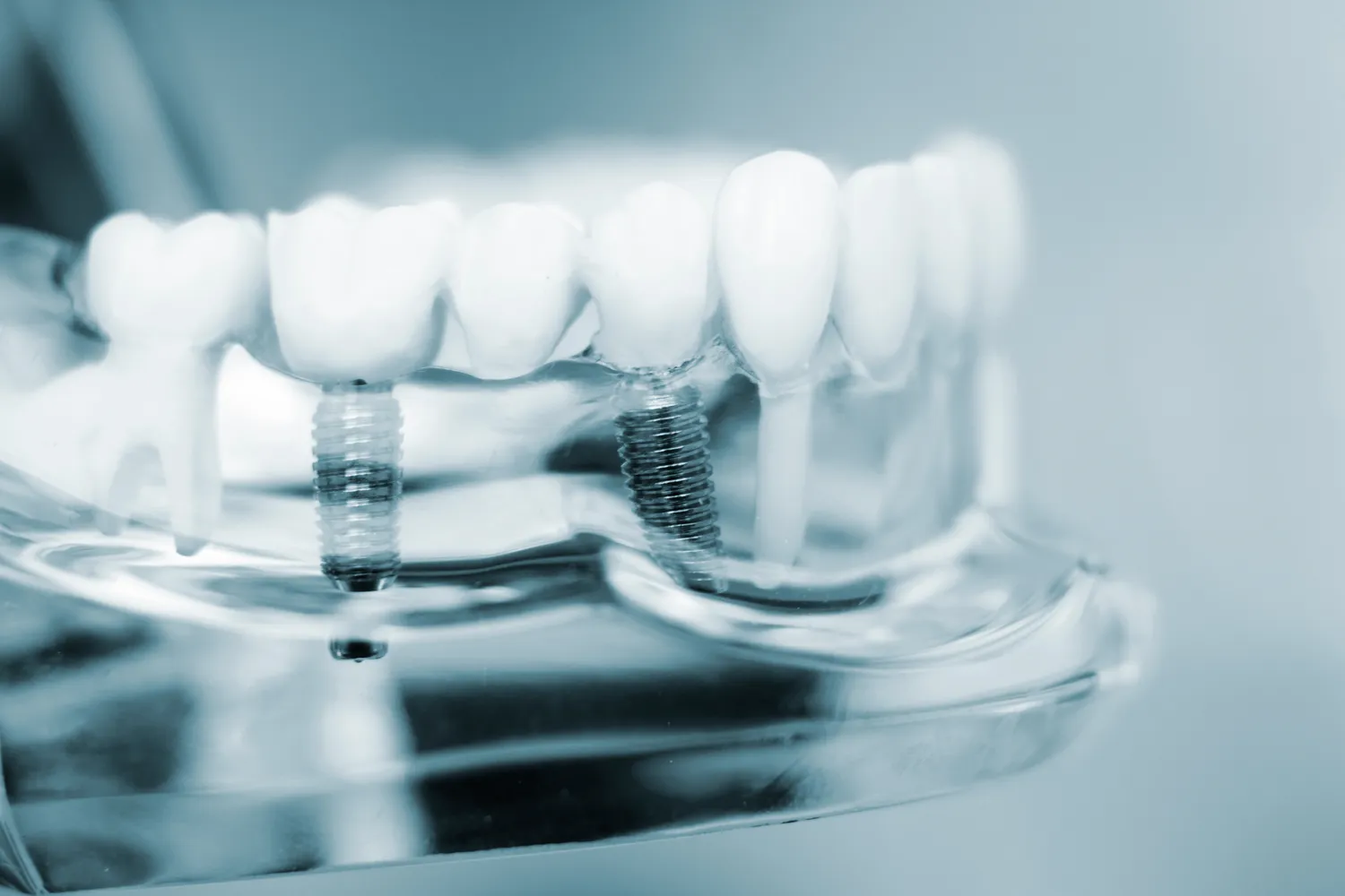 Czym się różni stomatolog od dentysty?