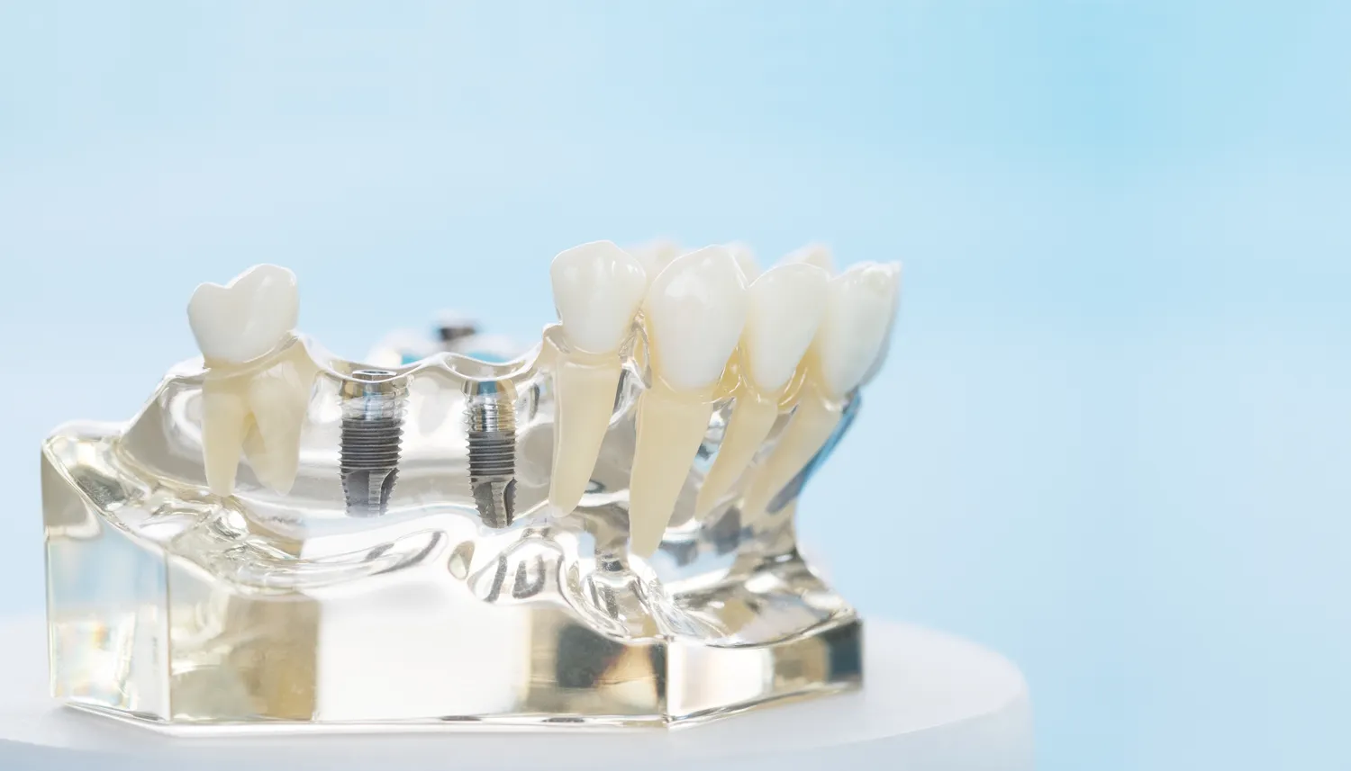 endodoncja-szczecin-1