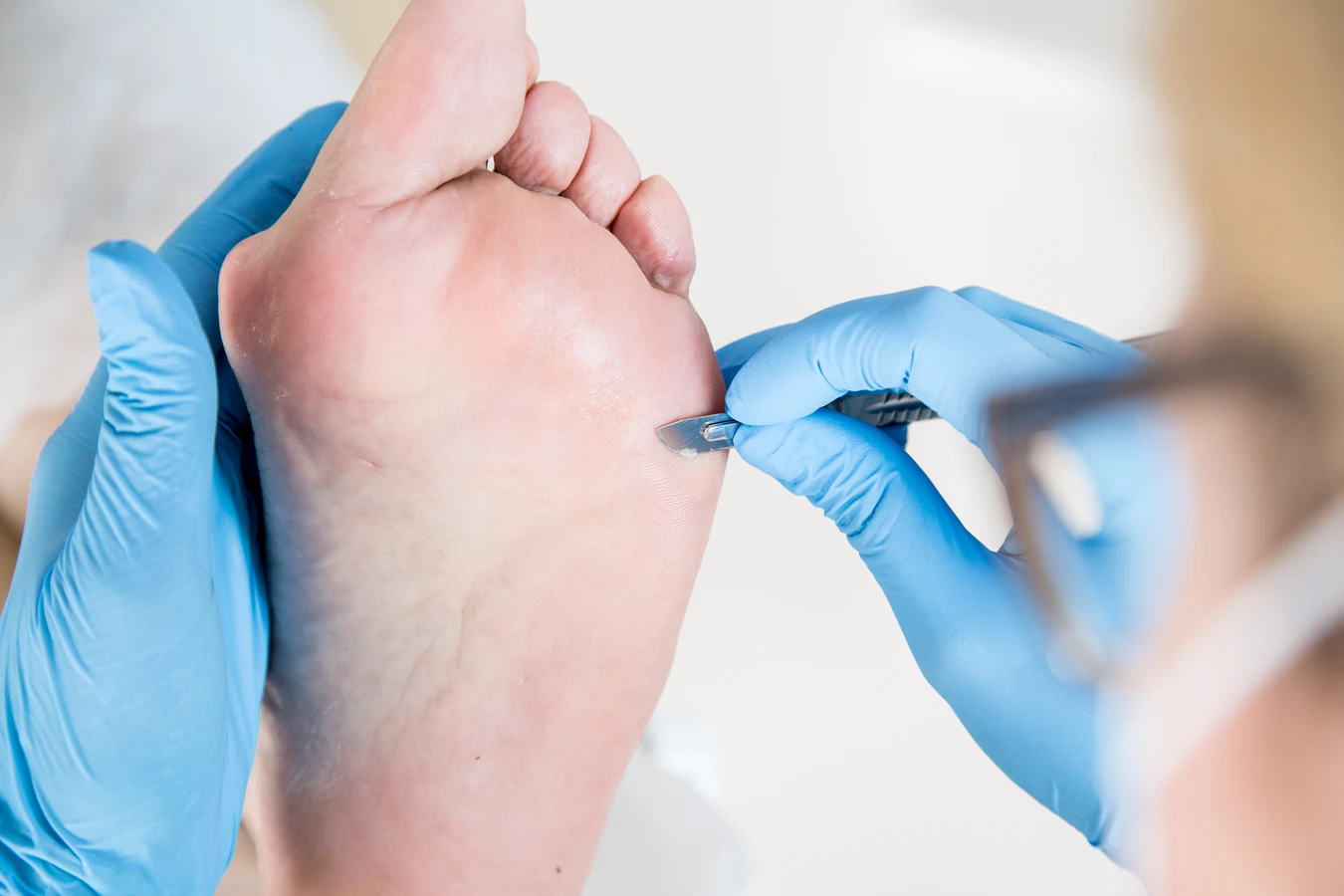 czym-zajmuje-sie-podologia-1