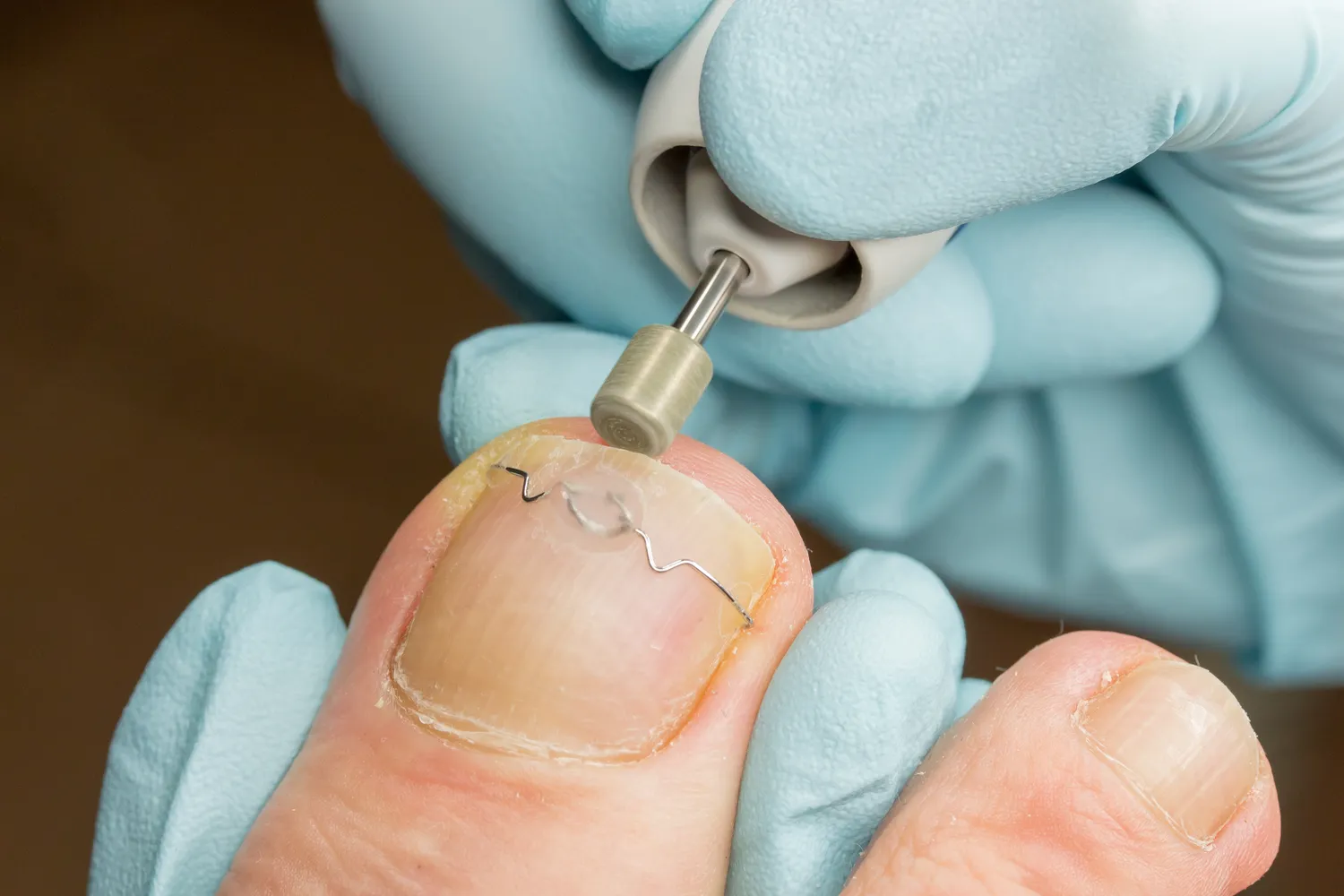 frezarka-do-paznokci-u-stop-jaka-wybrac-1