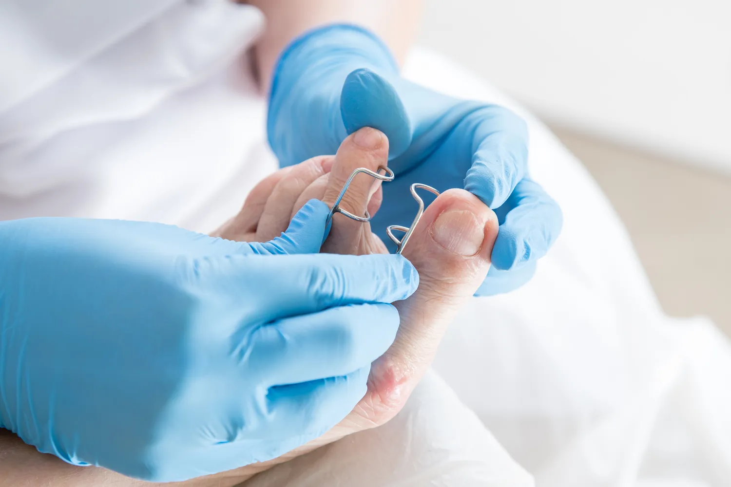 haluksy-choroba-xxi-wieku-1