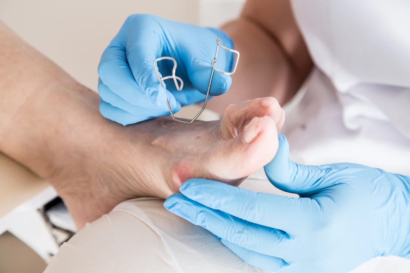 Czym są oraz jak radzić sobie z usuwaniem modzeli?