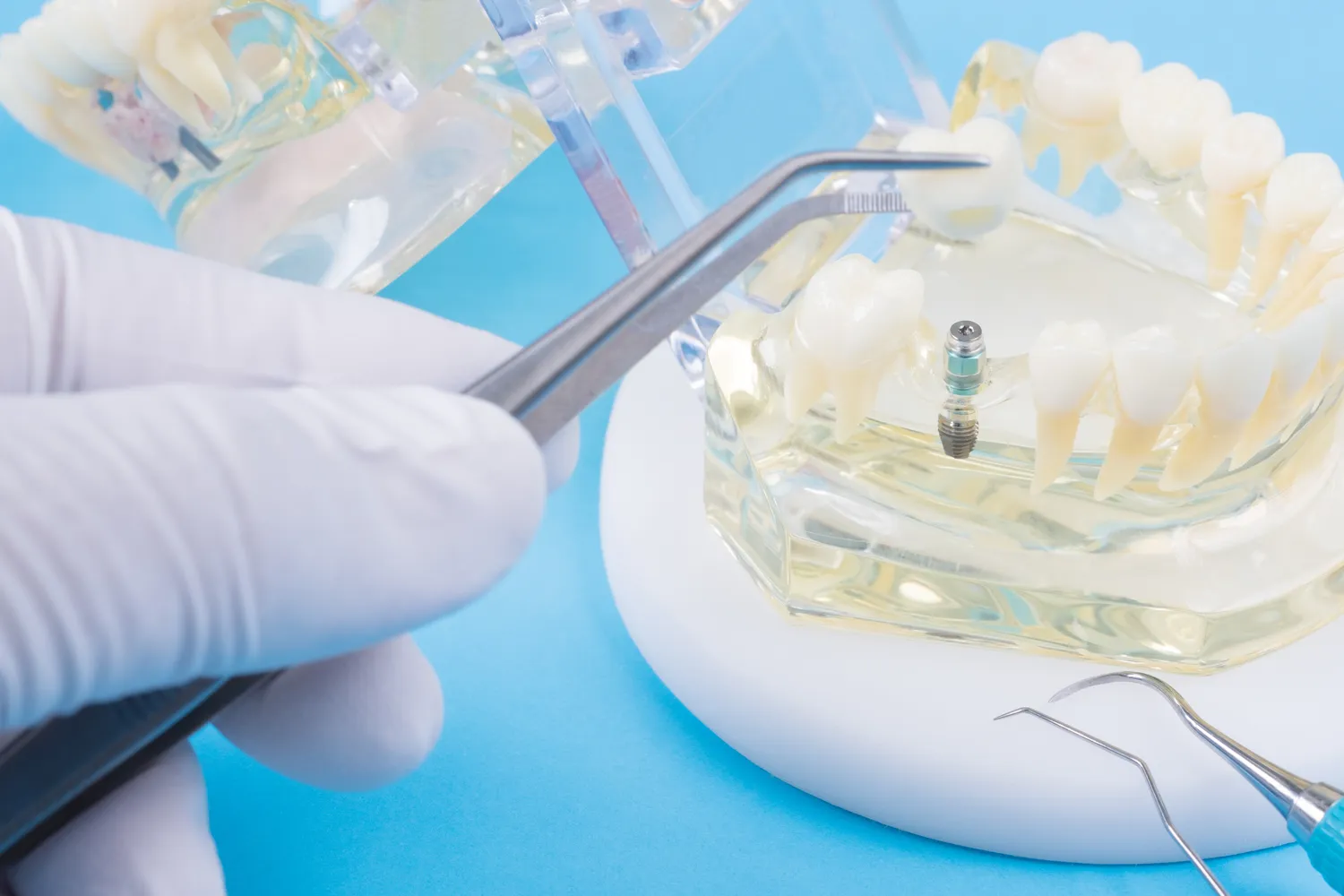 zeby-w-jeden-dzien-kolobrzeg-1