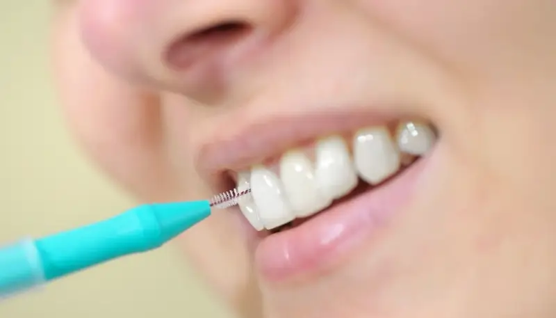 ile-trwa-leczenie-kanalowe-szostki-f